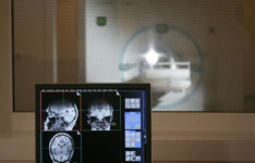 MRI成像方法在不使用放射性物质的情况下捕获大脑葡萄糖代谢